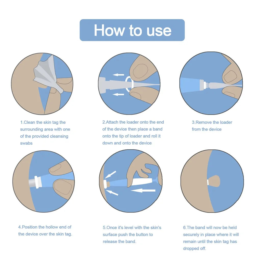 Advanced Skin Tag & Mole Removal Kit – Precision Skin Cleansing Tool for 2–4mm Tags & Warts