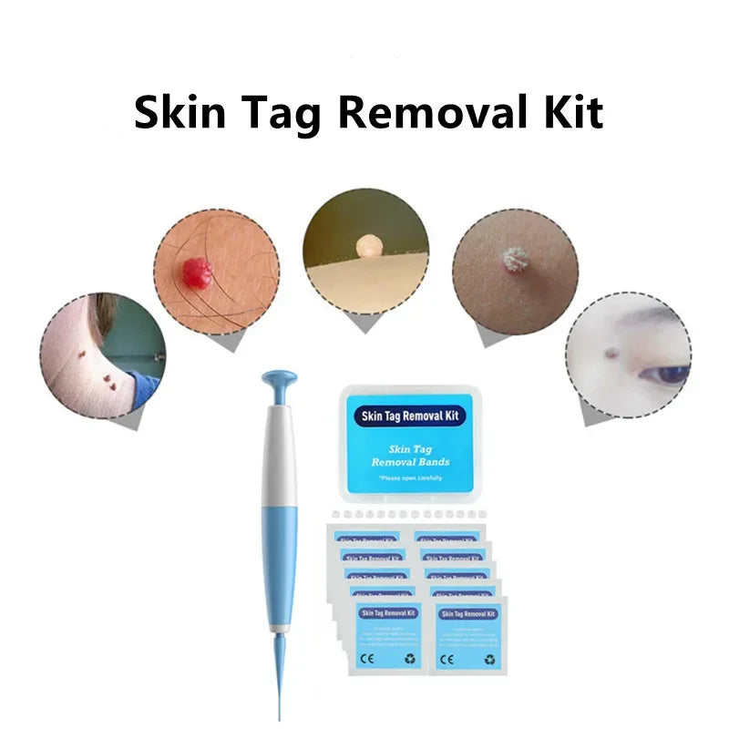 Advanced Skin Tag & Mole Removal Kit – Precision Skin Cleansing Tool for 2–4mm Tags & Warts