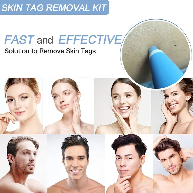 Advanced Skin Tag & Mole Removal Kit – Precision Skin Cleansing Tool for 2–4mm Tags & Warts