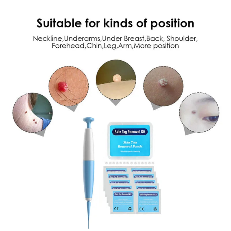 Advanced Skin Tag & Mole Removal Kit – Precision Skin Cleansing Tool for 2–4mm Tags & Warts