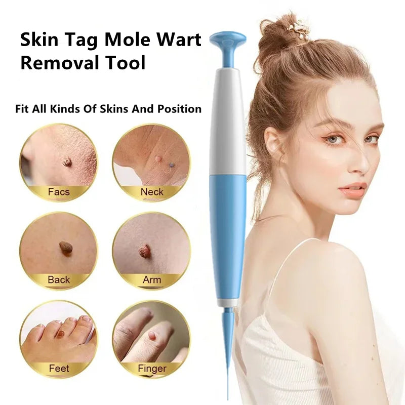 Advanced Skin Tag & Mole Removal Kit – Precision Skin Cleansing Tool for 2–4mm Tags & Warts