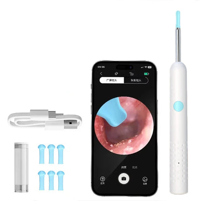 Visual Ear Cleaner with 1296P Camera & 6 LED Lights - Wireless WI-FI Smart Ear Wax Removal Tool with USB-C Charging
